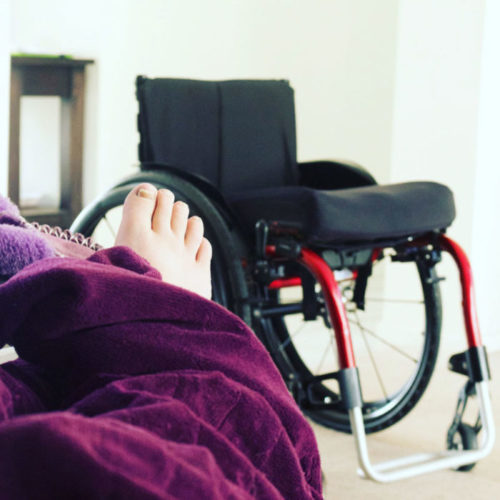 NDIS patient story