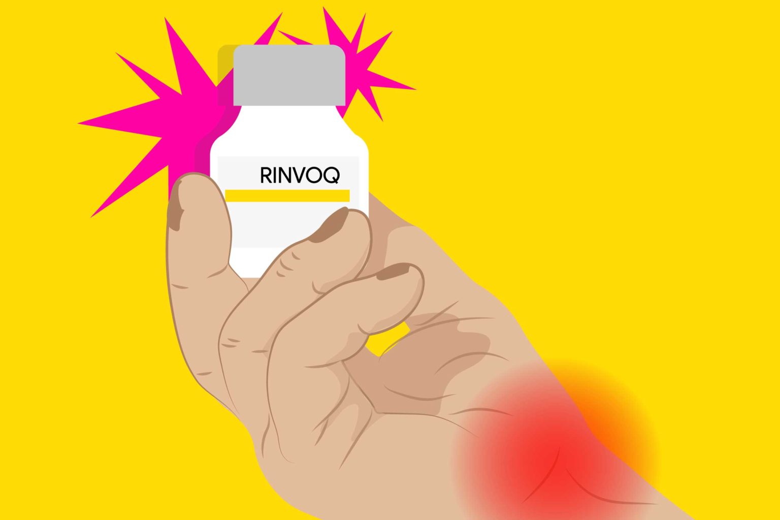 Rinvoq®: New Treatment Available Through PBS For Rheumatoid Arthritis ...