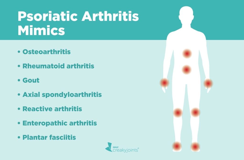 7 Diseases That Can Mimic Psoriatic Arthritis And Delay Your Diagnosis Creakyjoints Australia