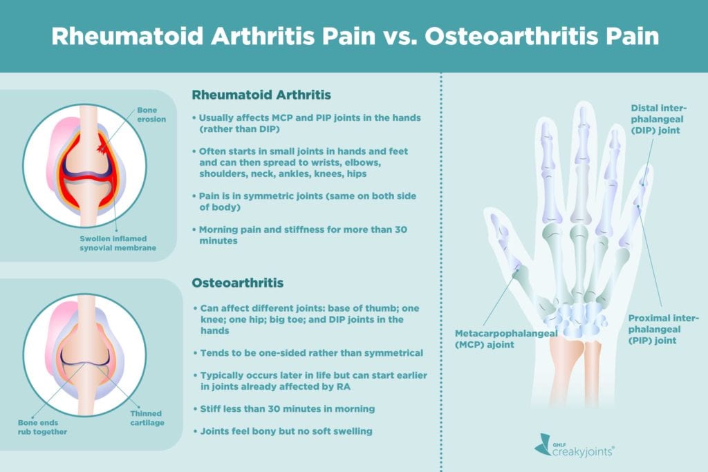 Rheumatoid arthritis pain versus osteoarthritis pain